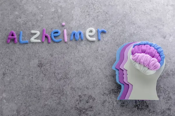 Rahasia Otak Sehat: Kebiasaan Sederhana yang Dapat Dilakukan Setiap Hari